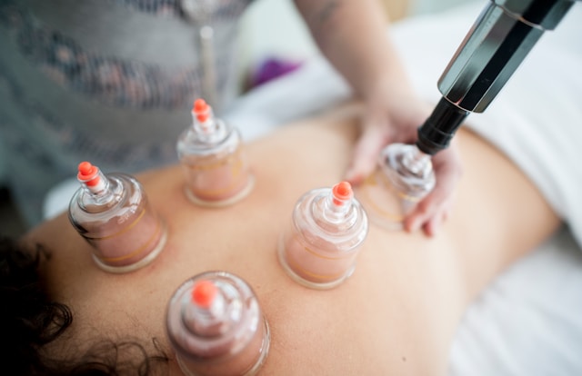 How Cupping Helps Detoxify the Body and Boost Immunity