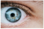 LASIK