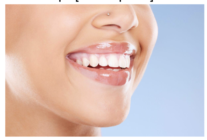Where to Buy Authentic Crest 3D White Strips [2025 Update]