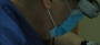 dental